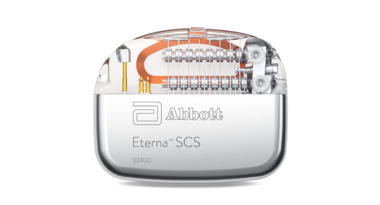 Abbott's SCS Systems OK'ed for Back Pain Patients with Limited