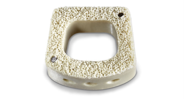 健康・医学 BIOCERAM POROUS IMPLANT BioHorizons® - Preat Corporation