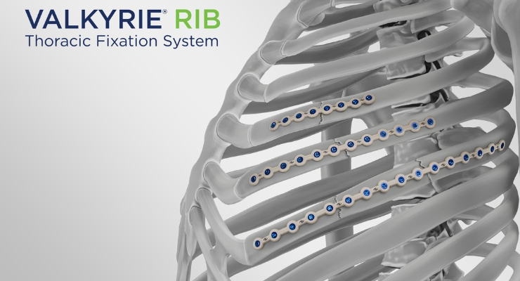 FDA OKs Able Medical's Valkyrie RIB for Thoracic Repair | ODT