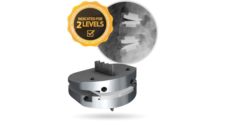 Two Level Disc Replacement FDA Approves Centinel Spine's Two-level prodisc L Total Disc ...