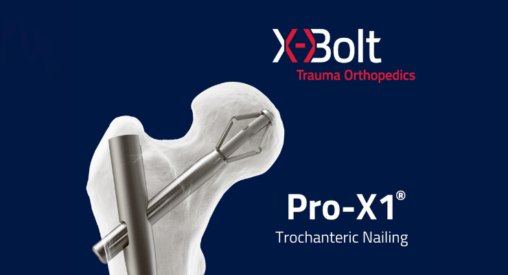 X-Bolt's Pro-X1 Trochanteric Nailing System Makes U.S. Debut - ODT