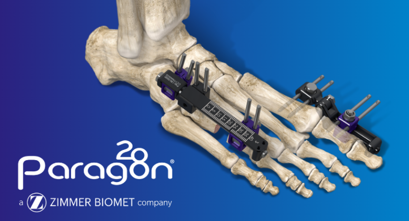 Zimmer Ribfx System Zimmer Biomet Debuts New Foot and Ankle Fixation System | ODT