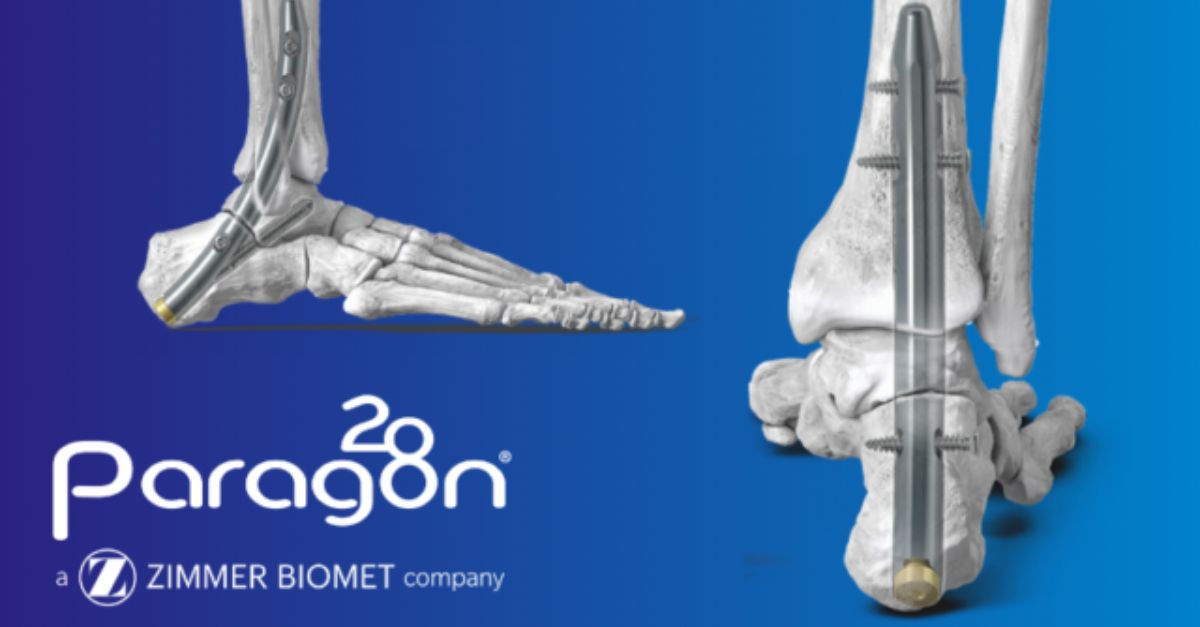 Zimmer Biomet, Paragon 28 Roll Out Phantom Curved TTC Nail